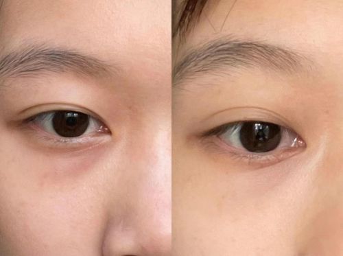 24年度眼霜top6纯眼周干货分享AG旗舰厅什么眼霜去皱效果好？20(图6)