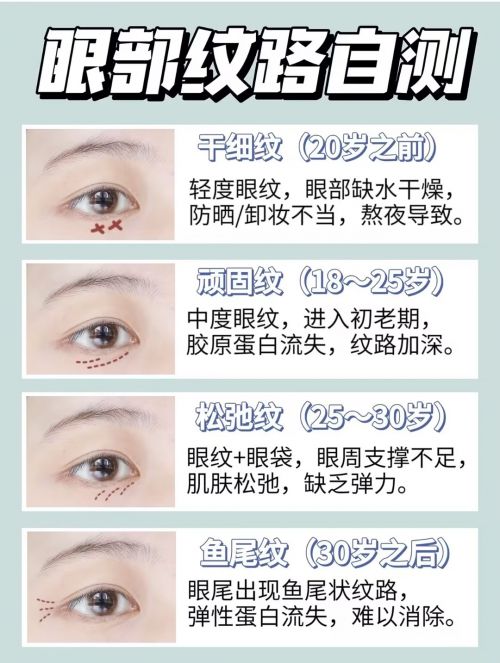 24年度眼霜top6纯眼周干货分享AG旗舰厅什么眼霜去皱效果好？20(图9)