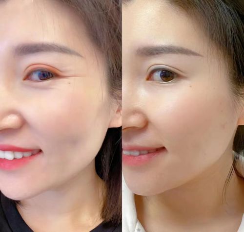 眼霜选择攻略指南效果出色的十大推荐AG旗舰厅首页什么眼霜去皱效果好？(图9)